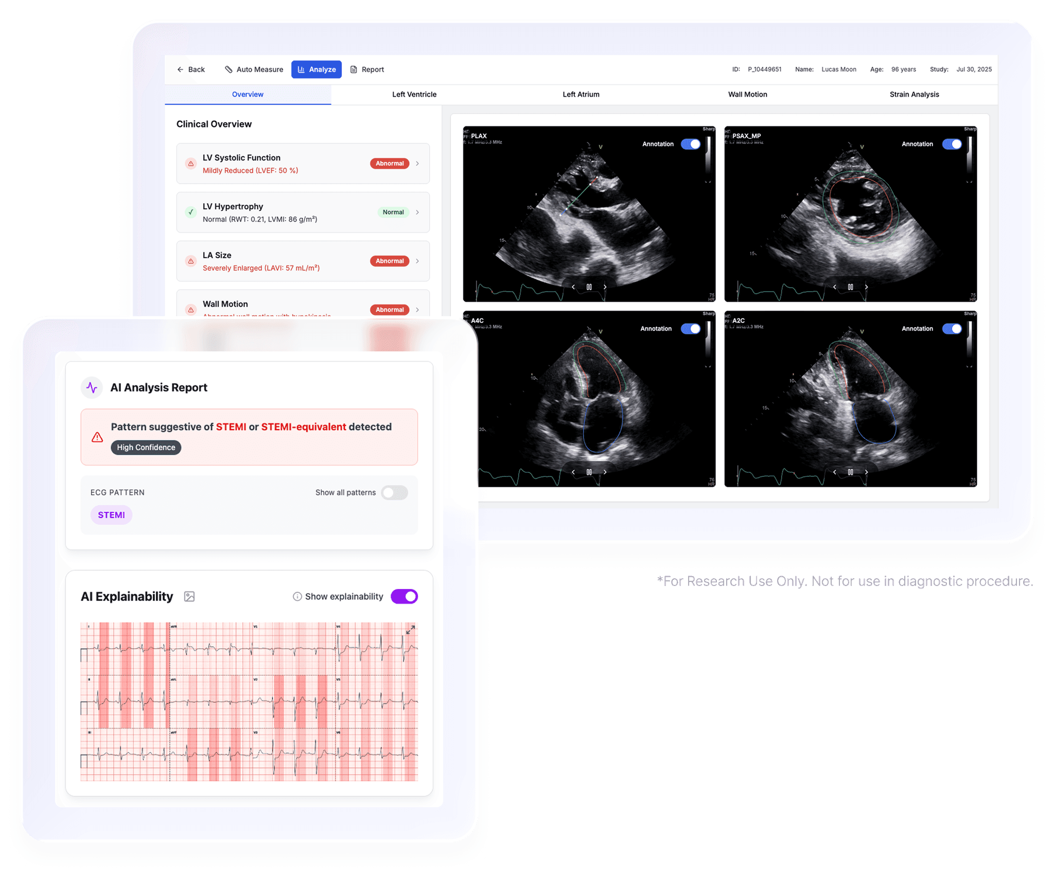 Screenshot of Evom AI Auto‑Echo / Auto‑ECG interface (placeholder)